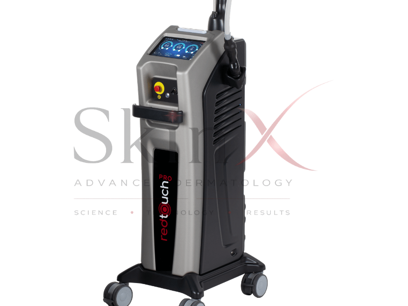 Dòng công nghệ laser 675nm giúp làn da cái thiện tình trạng tăng sắc tố 